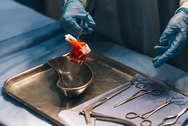 a surgeon handles bloody gauze pad