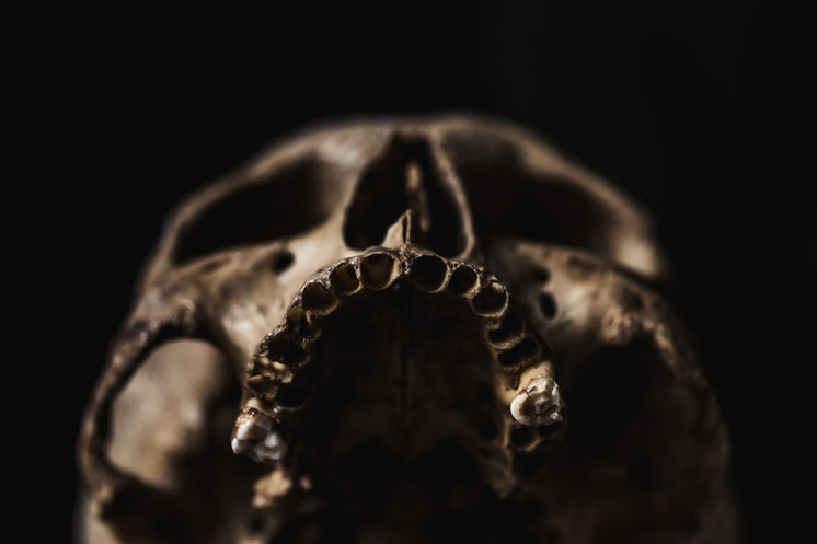 toothless-upper-jaw-of-human-skull.jpg?w